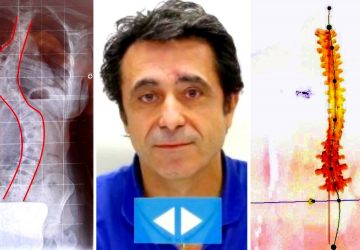 «Guarigioni della schiena? Attenti alle radiografie!»