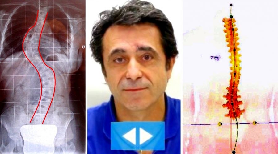«Guarigioni della schiena? Attenti alle radiografie!»