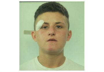 Catania: tenta rapina e nella fuga investe l&rsquo;anziana vittima. Arrestata una donna