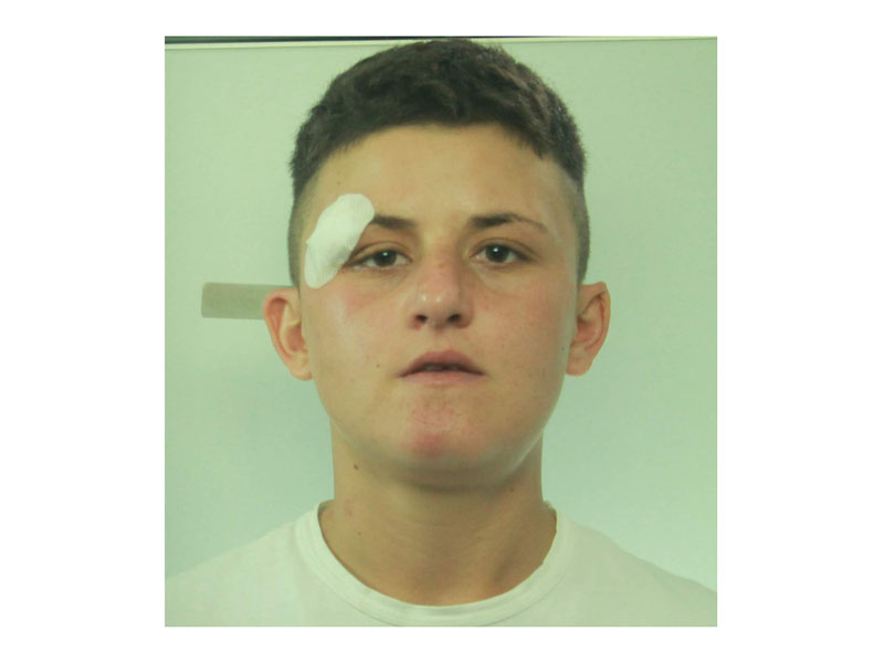 Catania: tenta rapina e nella fuga investe l’anziana vittima. Arrestata una donna