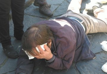 Giarre, cade a terra sbattendo la testa. Da 20 minuti attende ambulanza