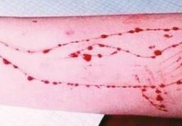 Caso di Blue Whale nel catanese interrotto dalla Polizia Postale: denunciato un 16enne