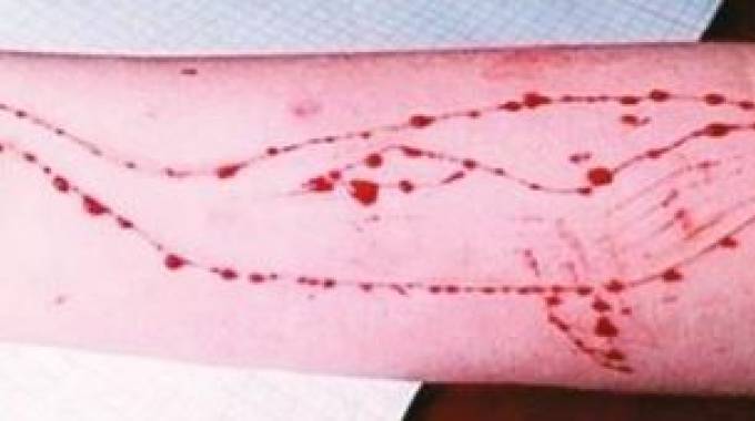 Caso di Blue Whale nel catanese interrotto dalla Polizia Postale: denunciato un 16enne