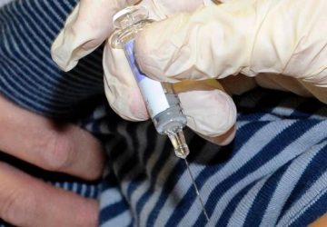 Catania, 42 enne muore di morbillo, in Italia &egrave; il quarto decesso del 2017