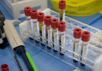 Mascali, caso bimbo deceduto: "era meningite"