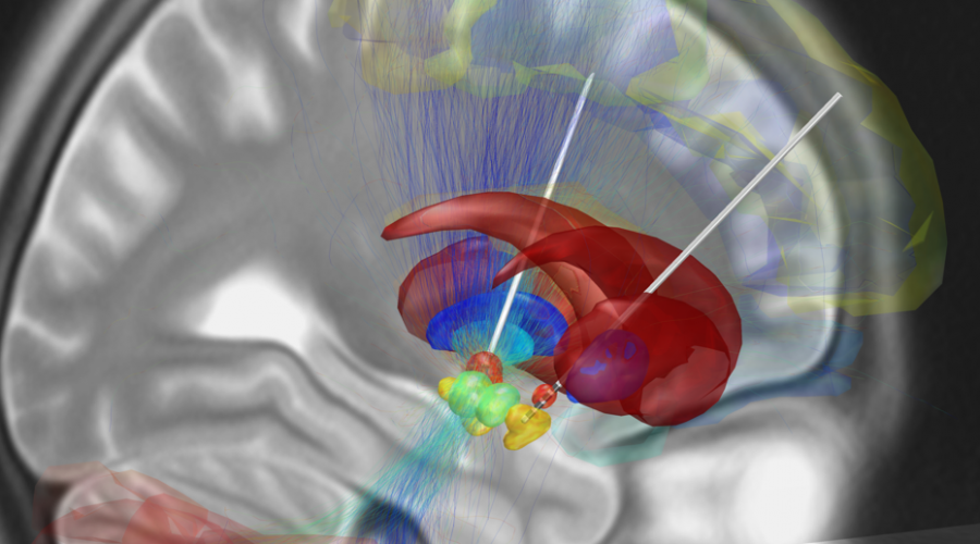 Clinica Villa Mafalda e la neurochirurgia di precisione