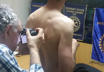 Maletto, screening gratuito delle lesioni pigmentate cutanee