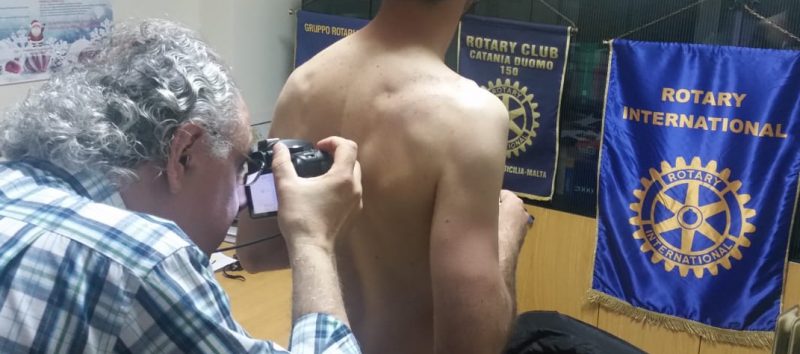 Maletto, screening gratuito delle lesioni pigmentate cutanee