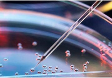 Turchia: cellule staminali per combattere l&rsquo;alopecia. Un&rsquo;alternativa al trapianto di capelli