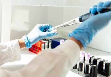 Coronavirus: in Sicilia sale a 83 il numero dei positivi