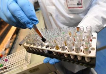 Coronavirus in Sicilia: 574 i nuovi positivi in pi&ugrave;. 202 nel Catanese