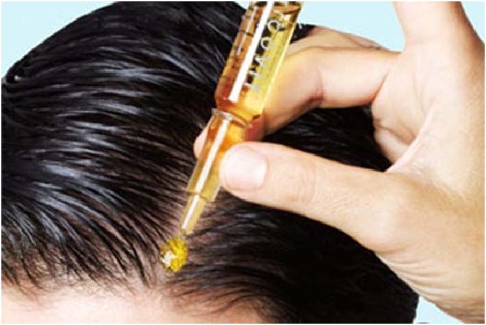 Fiale anticaduta: servono davvero? Quale le migliori?